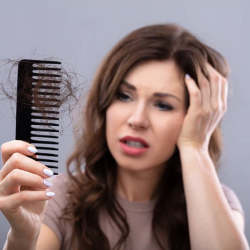 How to Stop Hair Fall Naturally: Effective Tips for Healthier Hair